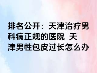 排名公开：天津治疗男科病正规的医院  天津男性包皮过长怎么办