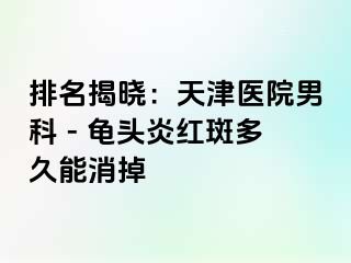 排名揭晓：天津医院男科 - 龟头炎红斑多久能消掉