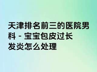 天津排名前三的医院男科 - 宝宝包皮过长发炎怎么处理